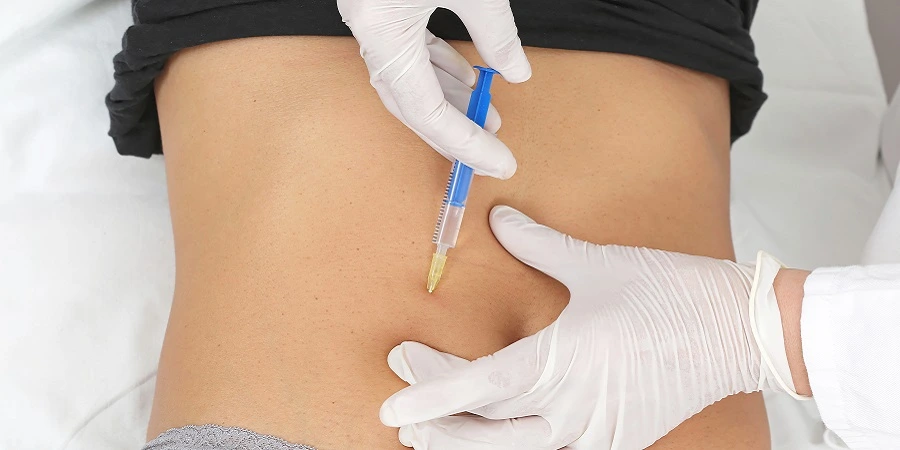 بوتاکس معده