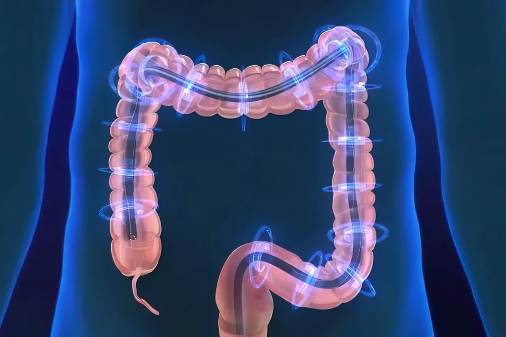 عوارض کولونوسکوپی با بیهوشی