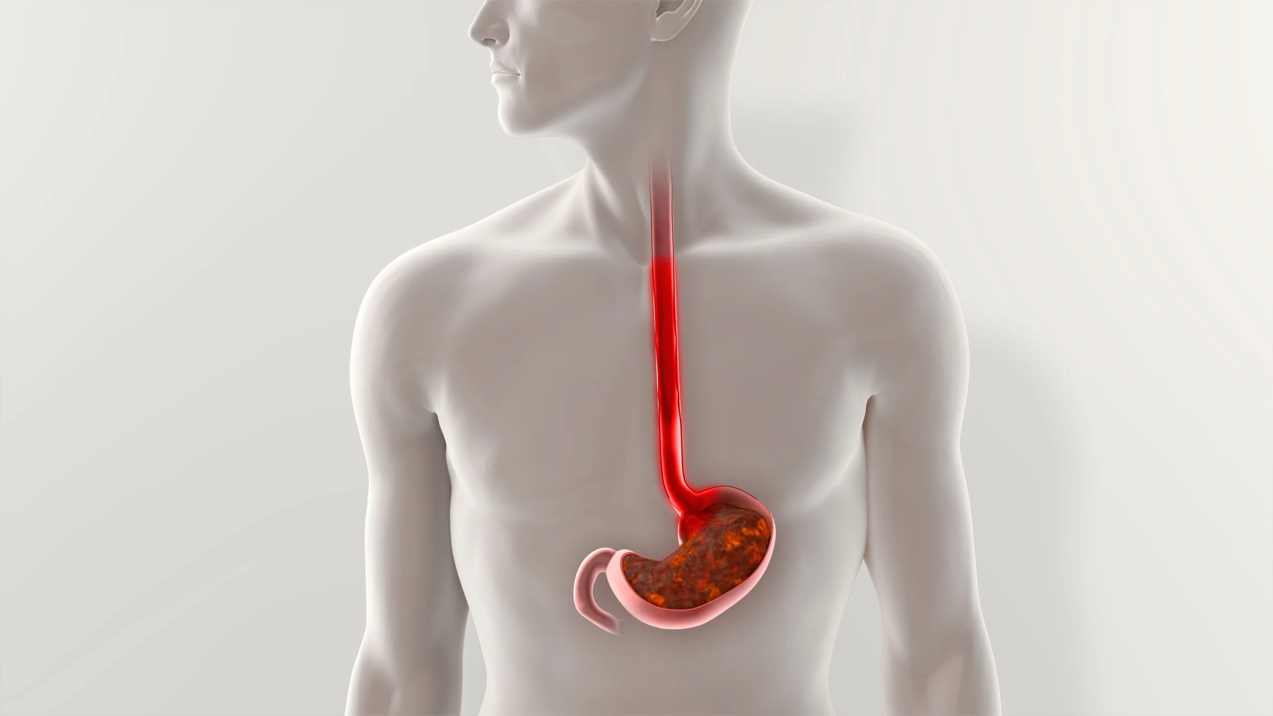 جدی ترین عوارض آندوسکوپی معده
