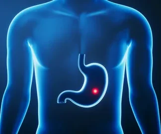 درمان پولیپ معده