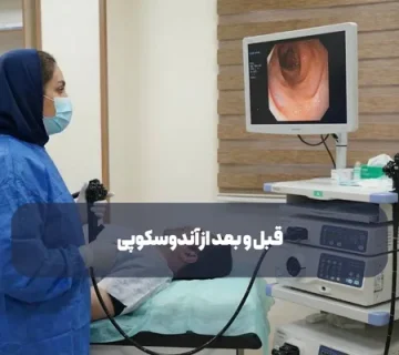 قبل و بعد از آندوسکوپی چه نکاتی را باید رعایت کنیم